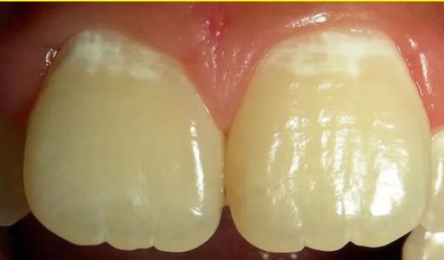 Splat Innova Паста зубная восстановление эмали и здоровье десен 75 мл