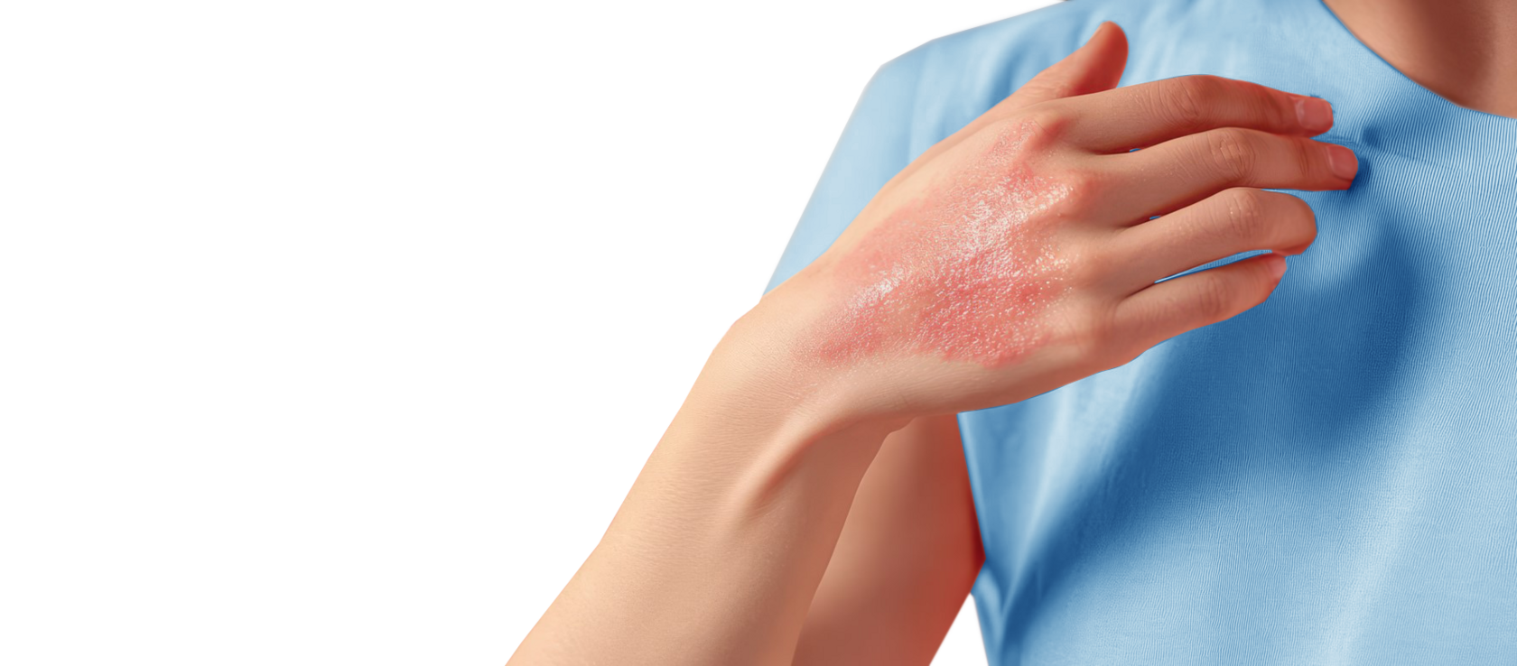 Итоговый контроль по дерматологии - презентация онлайн