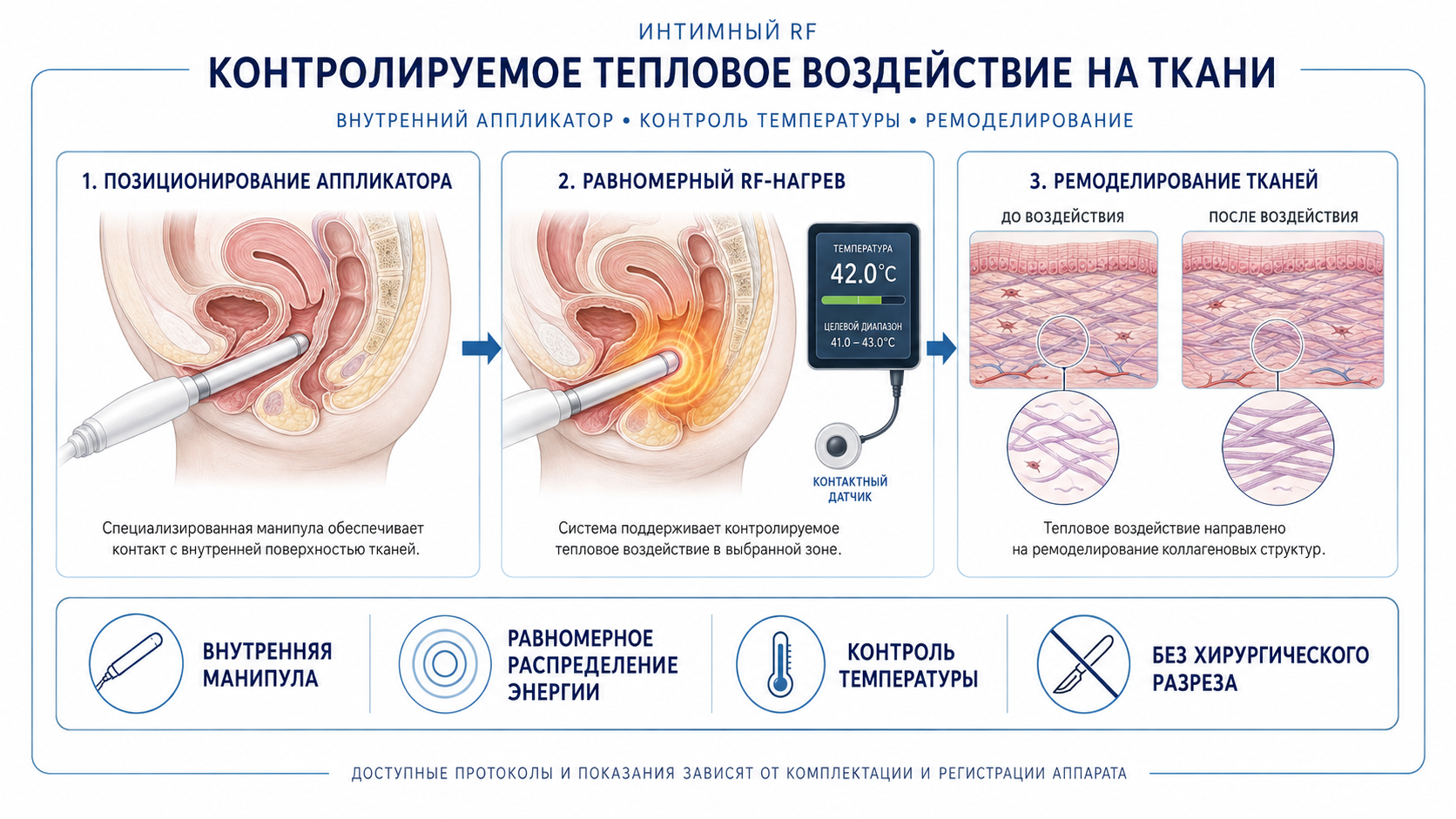 DUET V: схема VGN Thermal RF