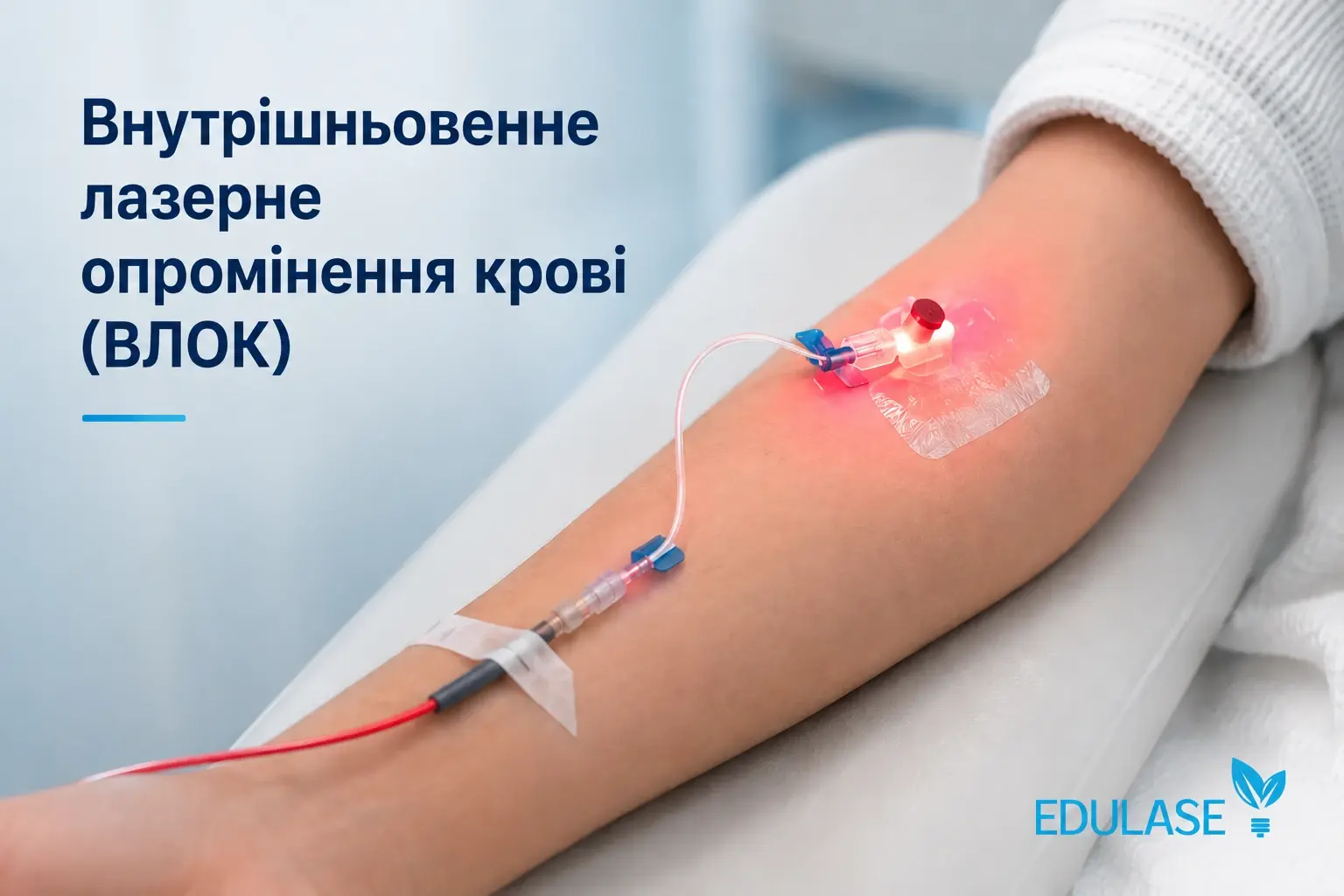 Внутрішньовенне лазерне опромінення крові ВЛОК — системна лазерна терапія