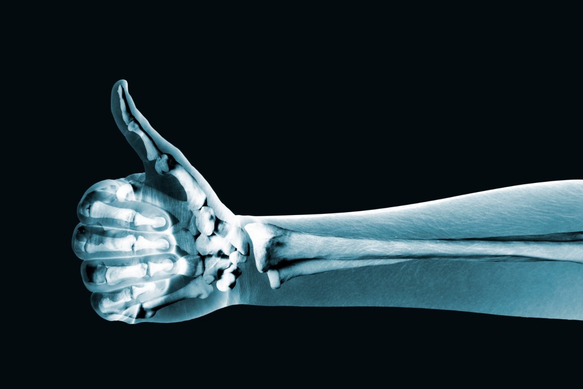 X-ray рентген