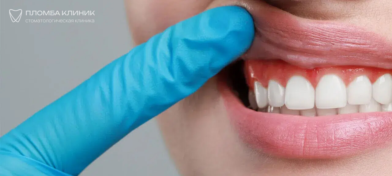 кровь при чистке зубов