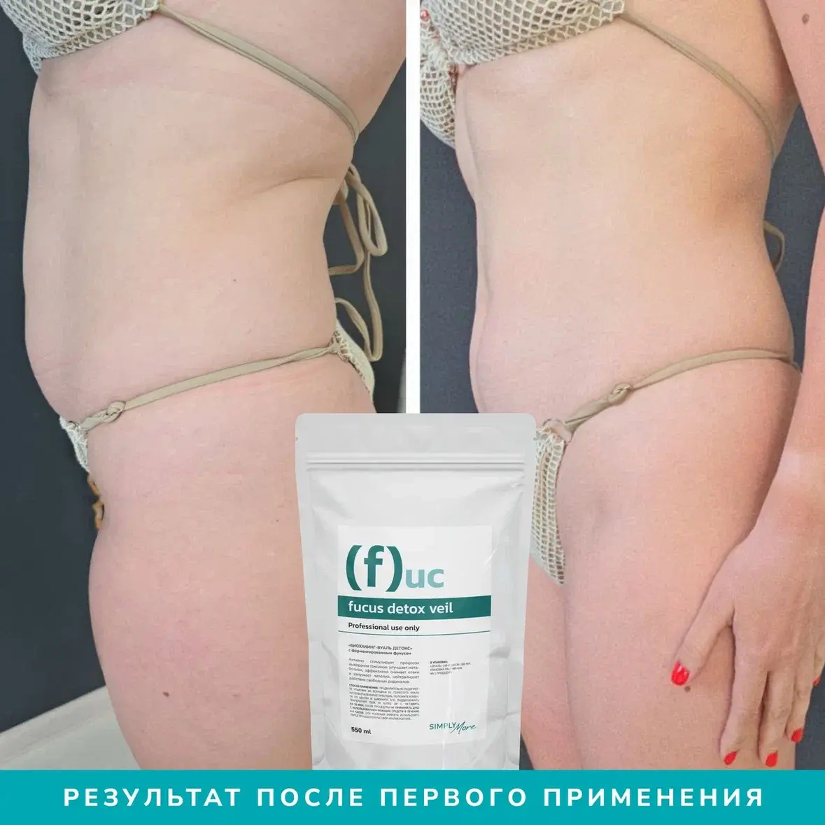 Результат после процедуры