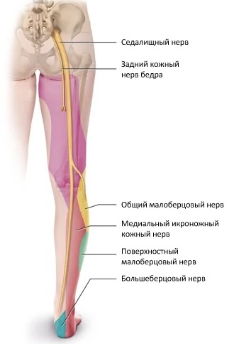 Седалищный нерв лечение без медикоментов