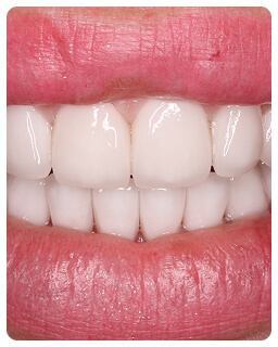 Протезирование зубов в Луганске