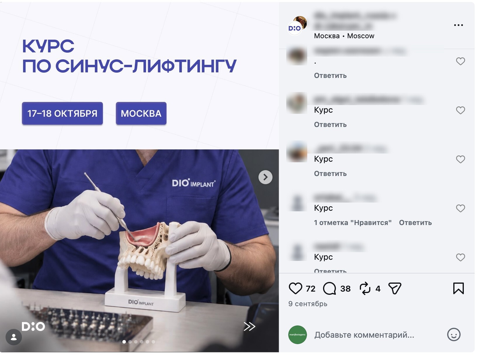 DIO Implant