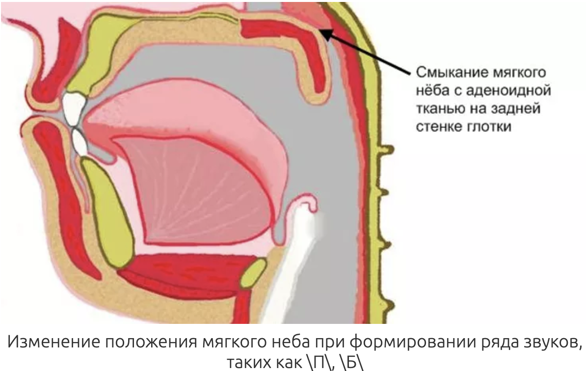 Мягкое небо при дыхании.