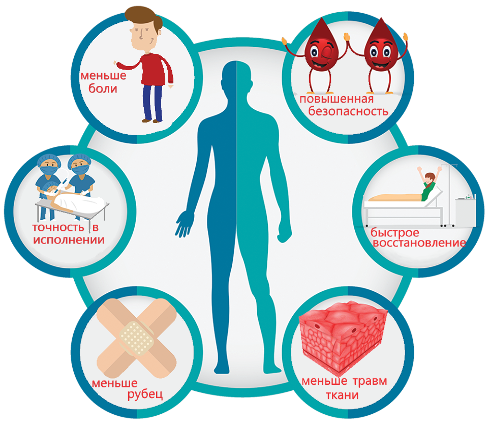 Отделение эндоскопической хирургии. Лапароскопия, торакоскопия в Харькове.