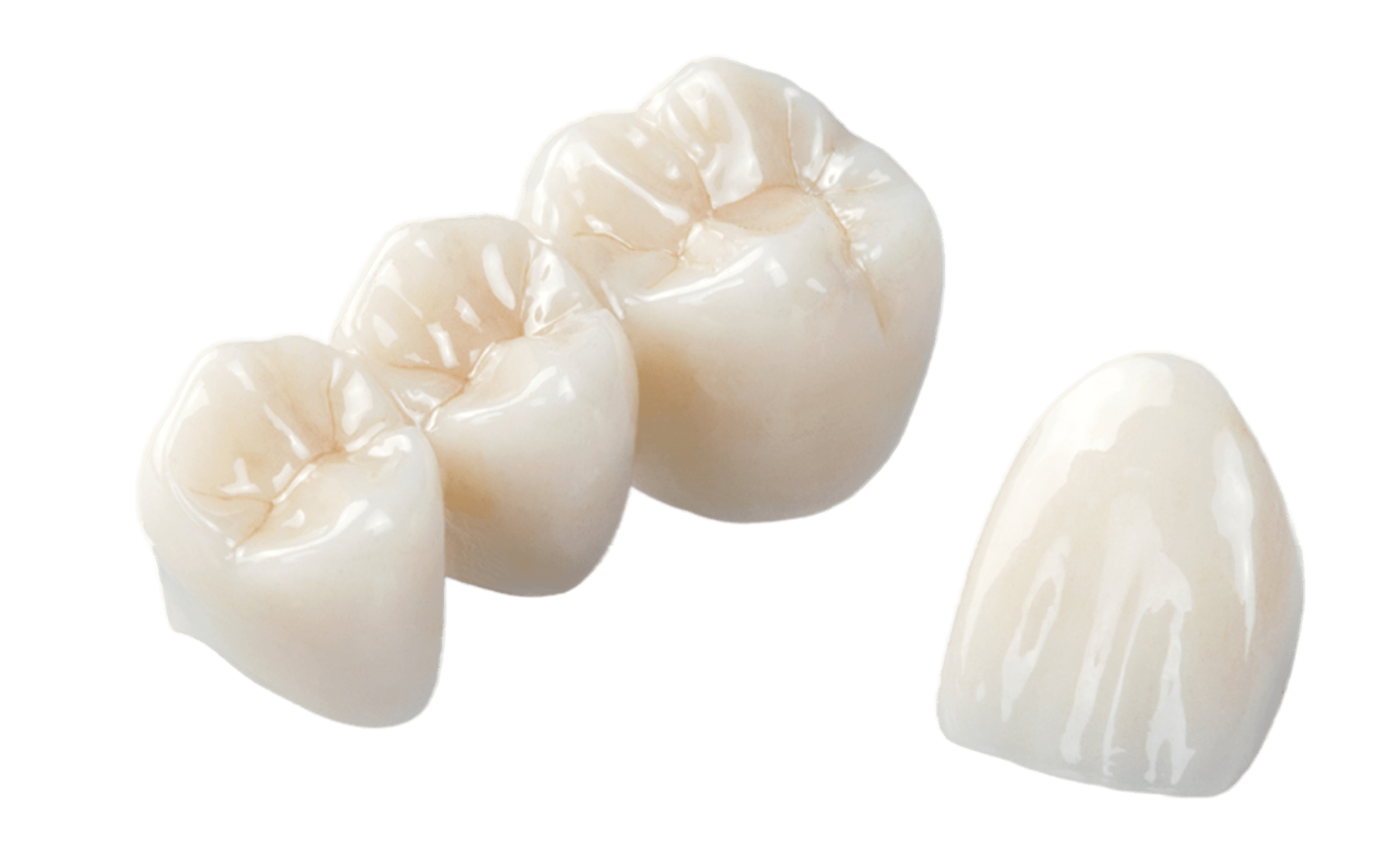 Имплантация зубов