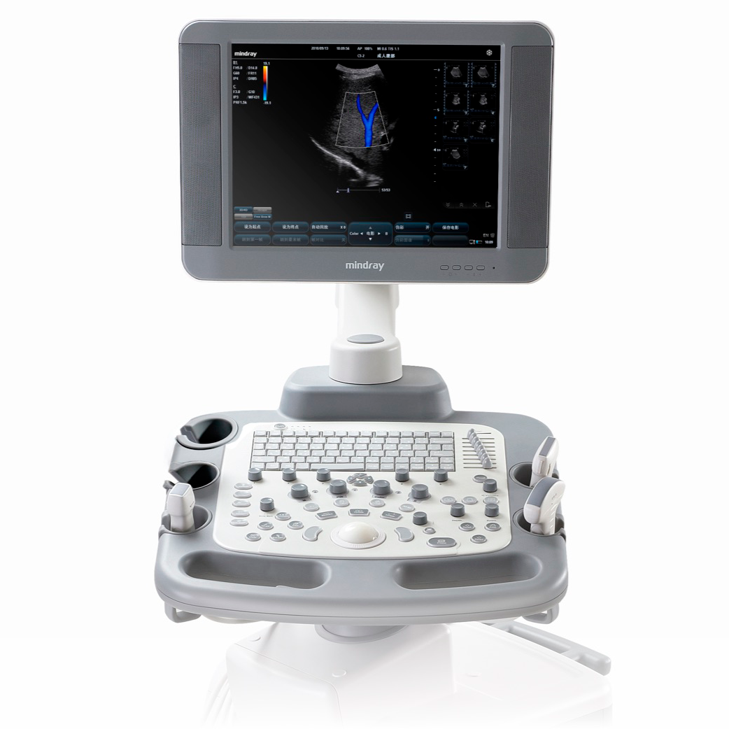 Mindray Dc 70 Купить 101 Мс