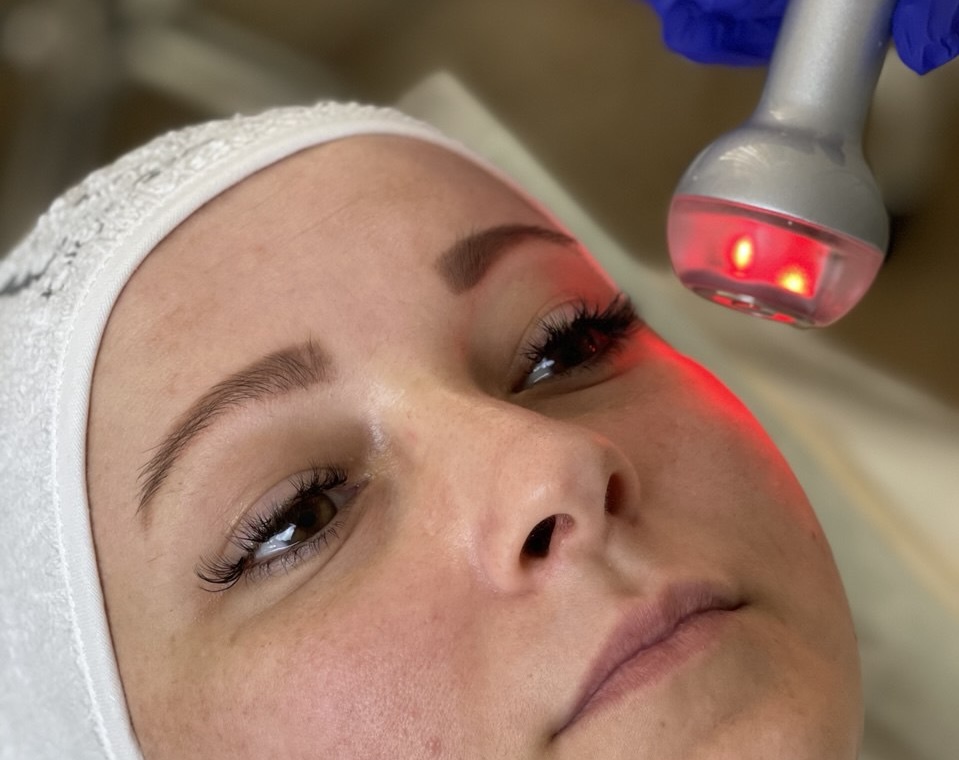 RF-лифтинг на IONTO Lift RF. Подтяжка кожи, которая запускает собственный коллаген