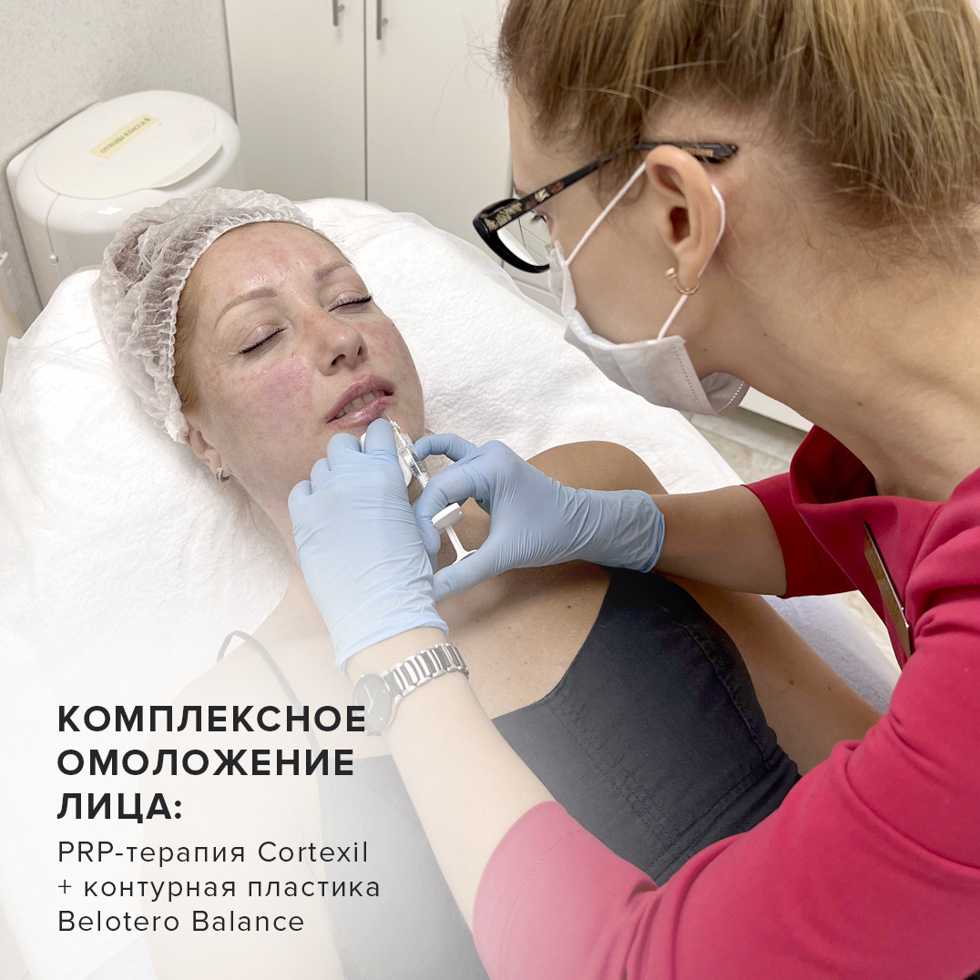 PRP терапия Cortexil. PRP Cortexil для лица отзывы. Cortexil PRP отзывы для лица реальные.