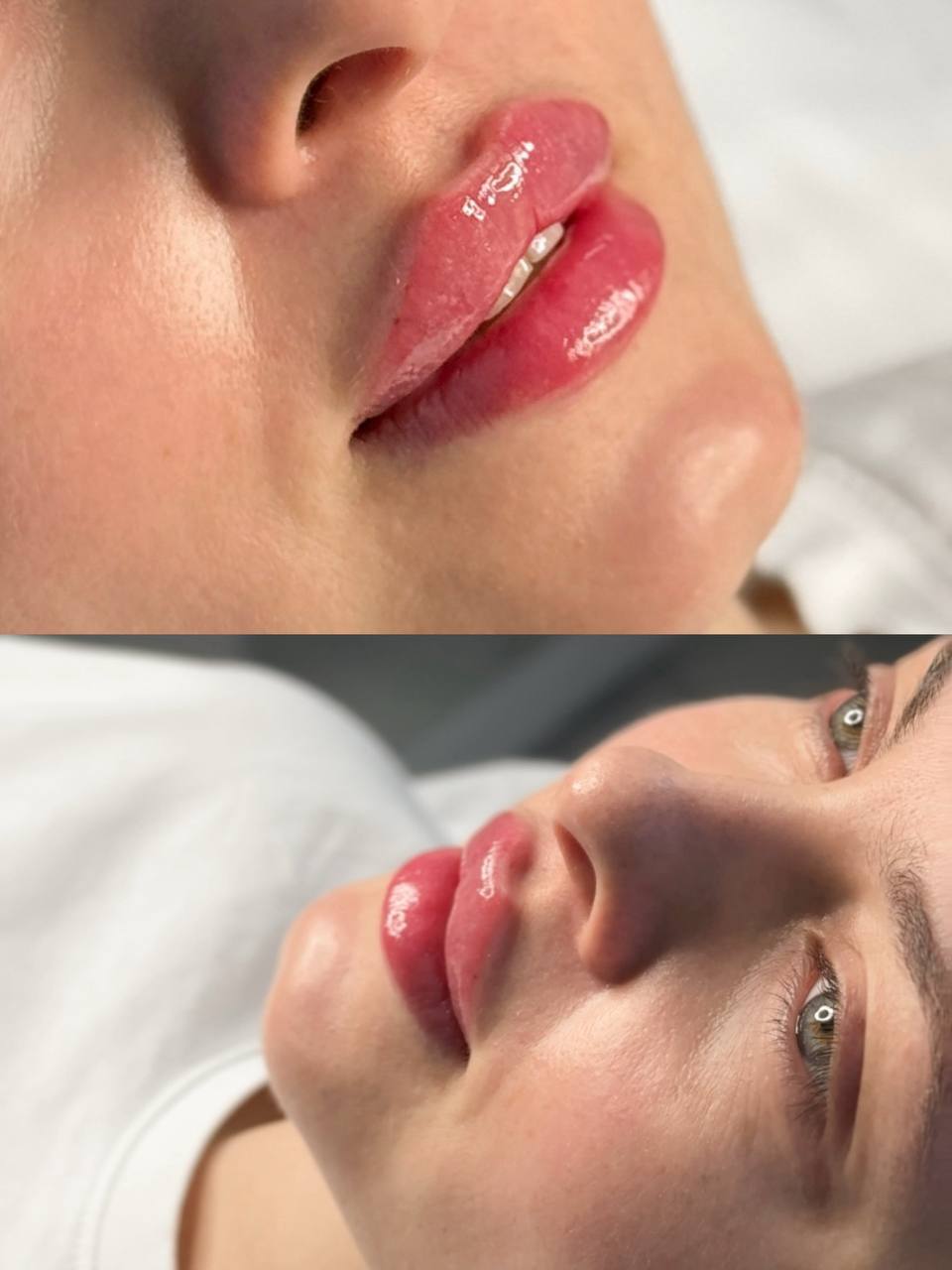 Материал из портфолио Inlove Beauty