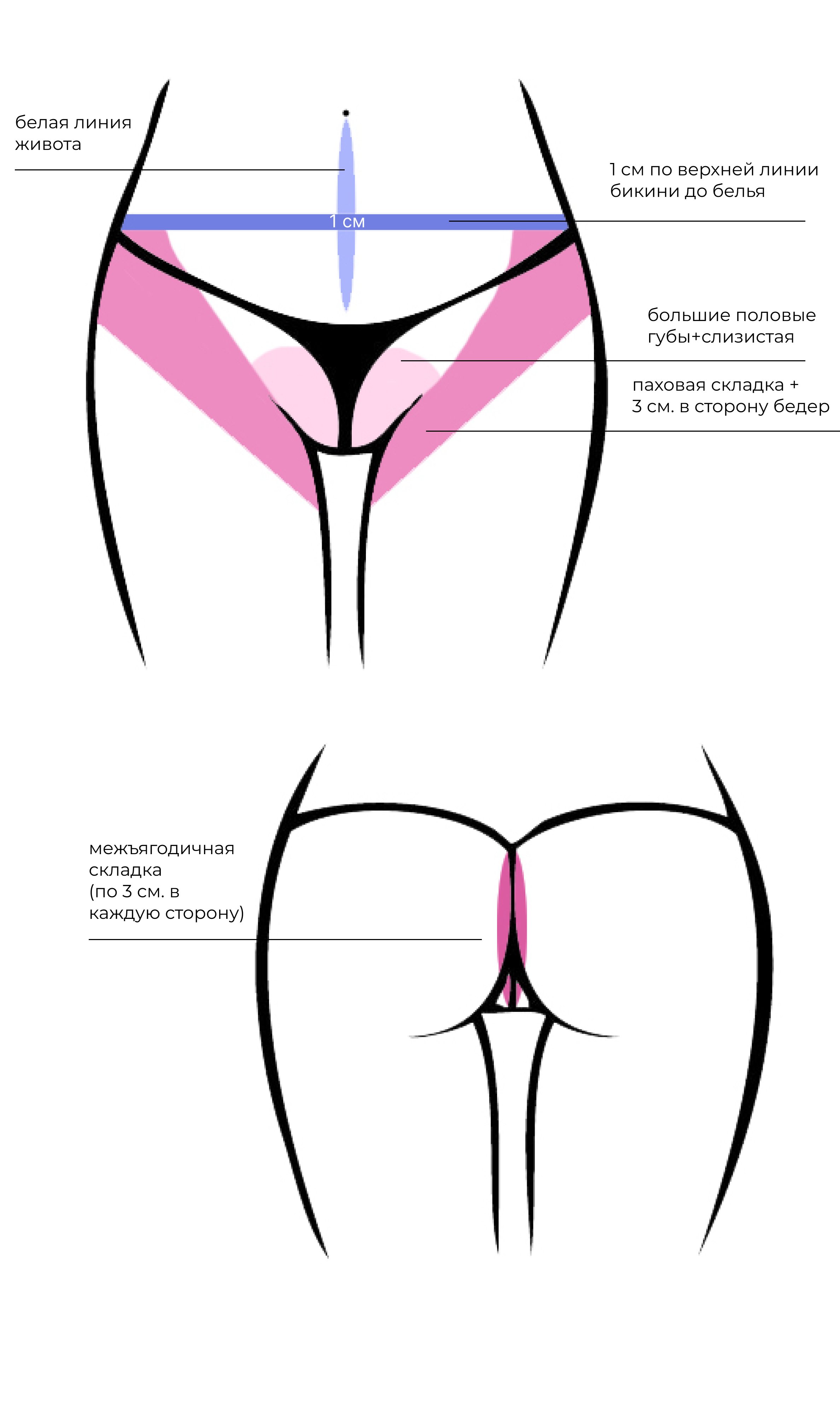 Схема шугаринга бикини глубокого по зонам