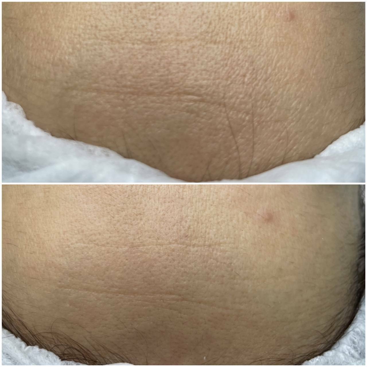 ДО/ПОСЛЕ ЭСТЕТИЧЕСКИХ ПРОЦЕДУР