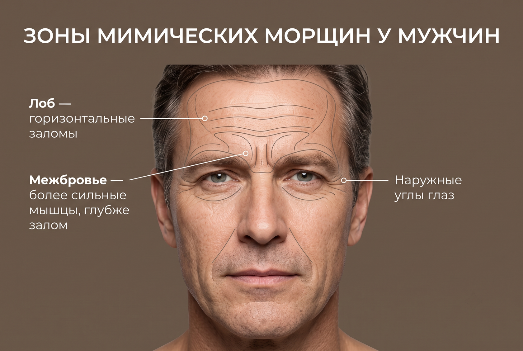 Зоны мимических морщин у мужчин