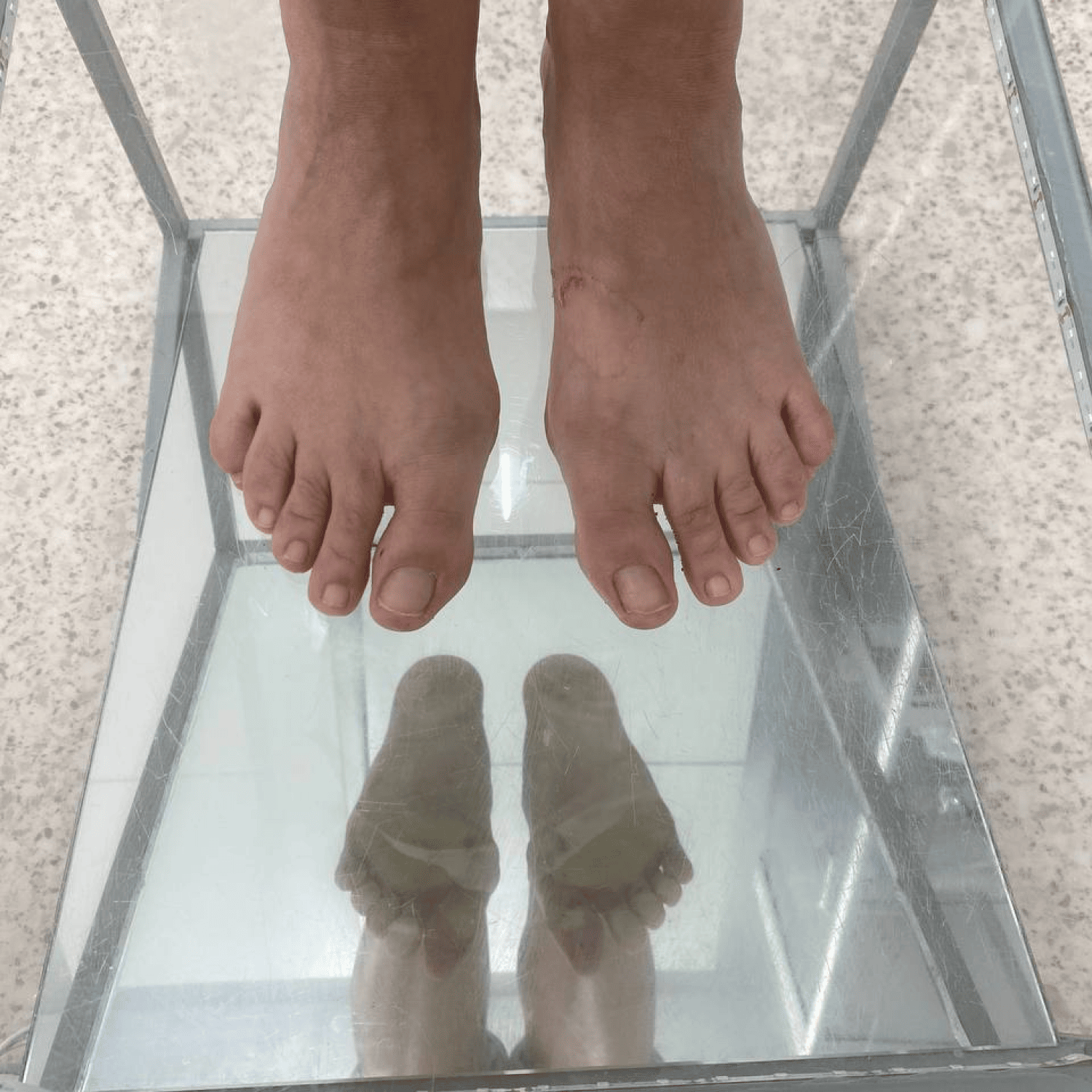 индивидуальные стельки, стельки +на заказ, стельки москва