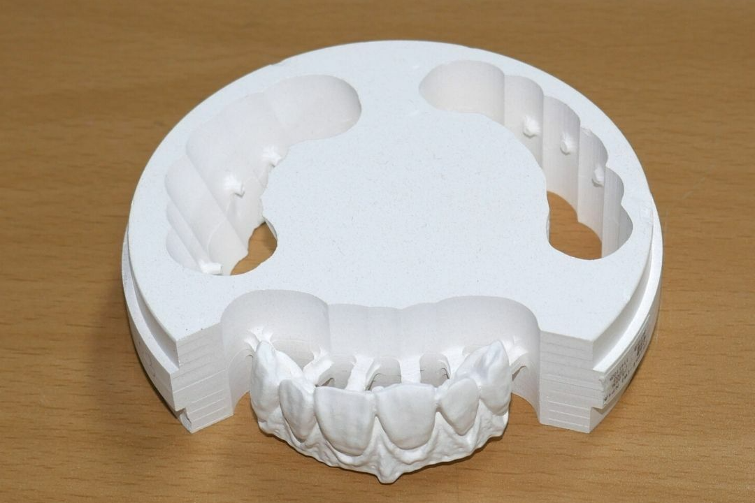 Dental Milling Machine Zirconia, Glass Ceramics, Custom Abutments