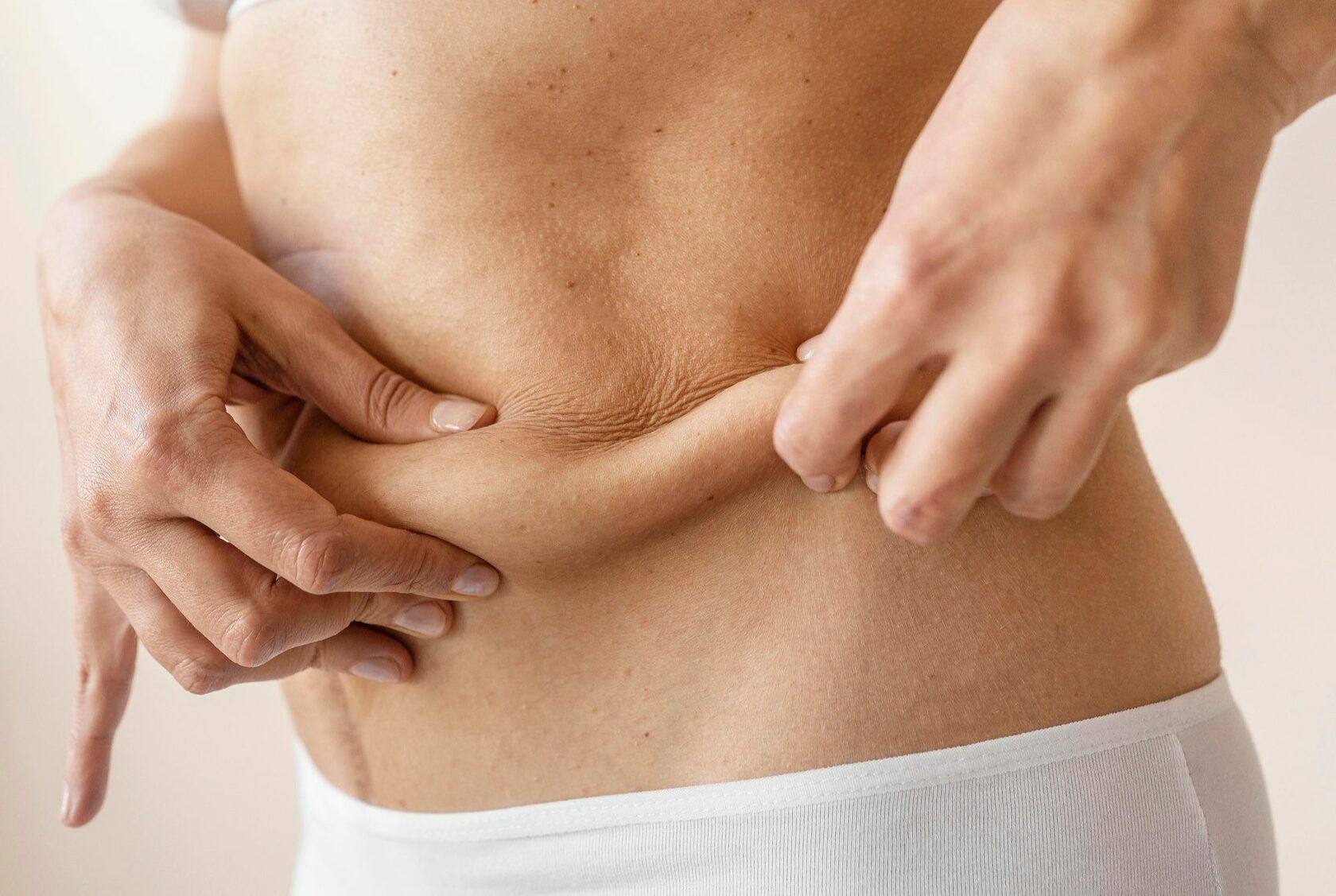 Устранение диастаза — абдоминопластика