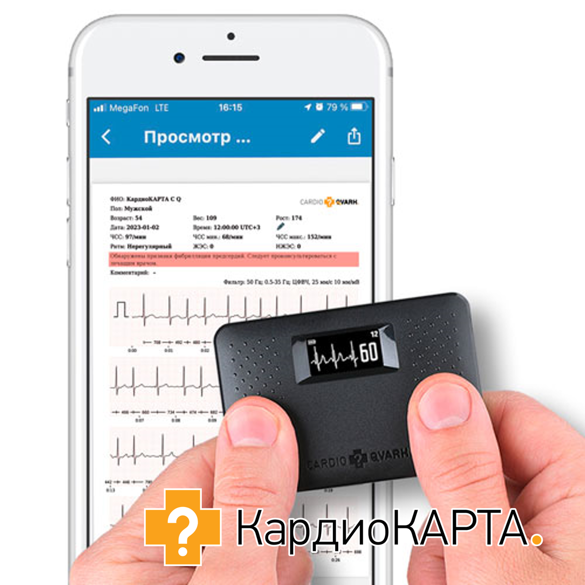 Компактное устройство для регистрации ЭКГ в домашних условиях КардиоКАРТА.