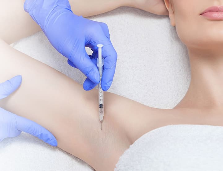 лечение гипергидроза