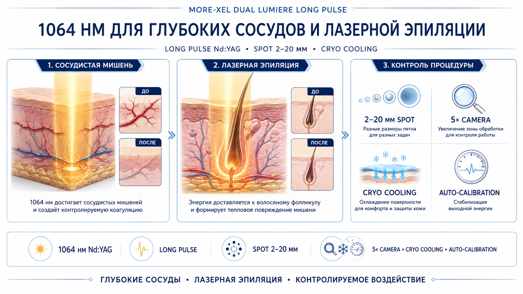 More-Xel Dual Lumiere Long Pulse: 1064 нм для сосудов и лазерной эпиляции