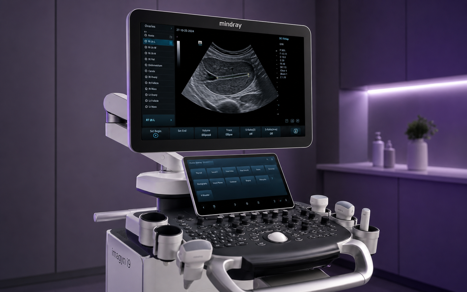 Mindray Imagyn I9 — экспертная УЗИ-диагностика в клинике Nouvelle