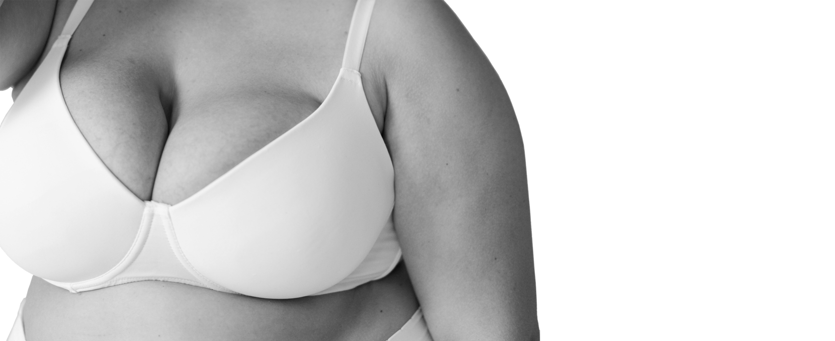 Уменьшение молочных желез (гигантомастия)