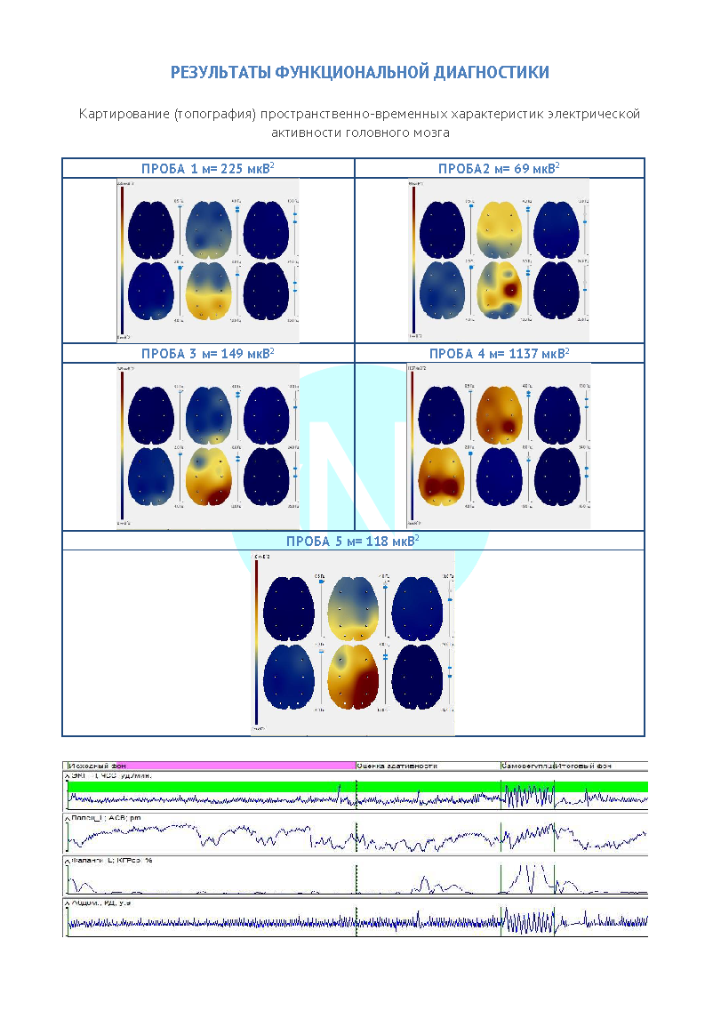 Нейродиагностика детей | Комплексные обследования и консультации родителей.