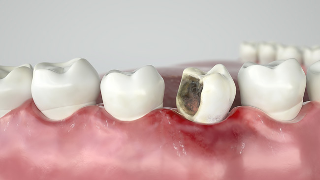 К какому стоматологу записаться для лечения зубов?