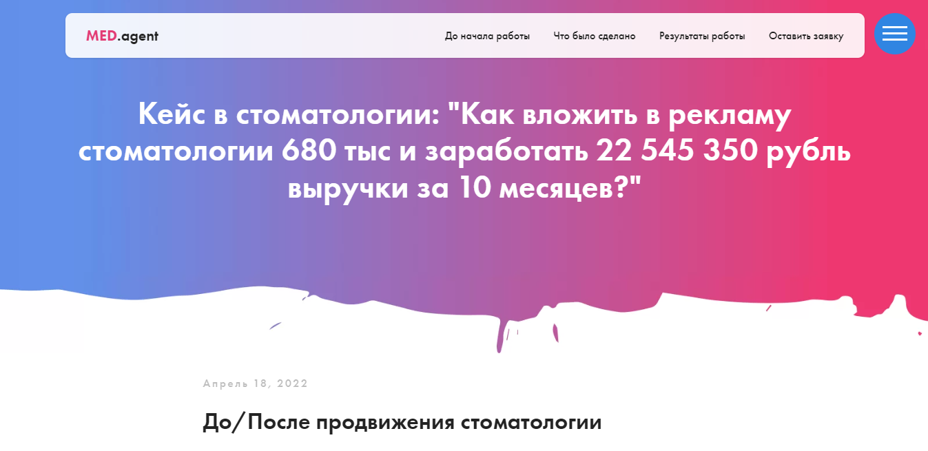 Вложили 680 тыс, заработали 22,5 млн ₽. Кейс рекламы в стоматологии