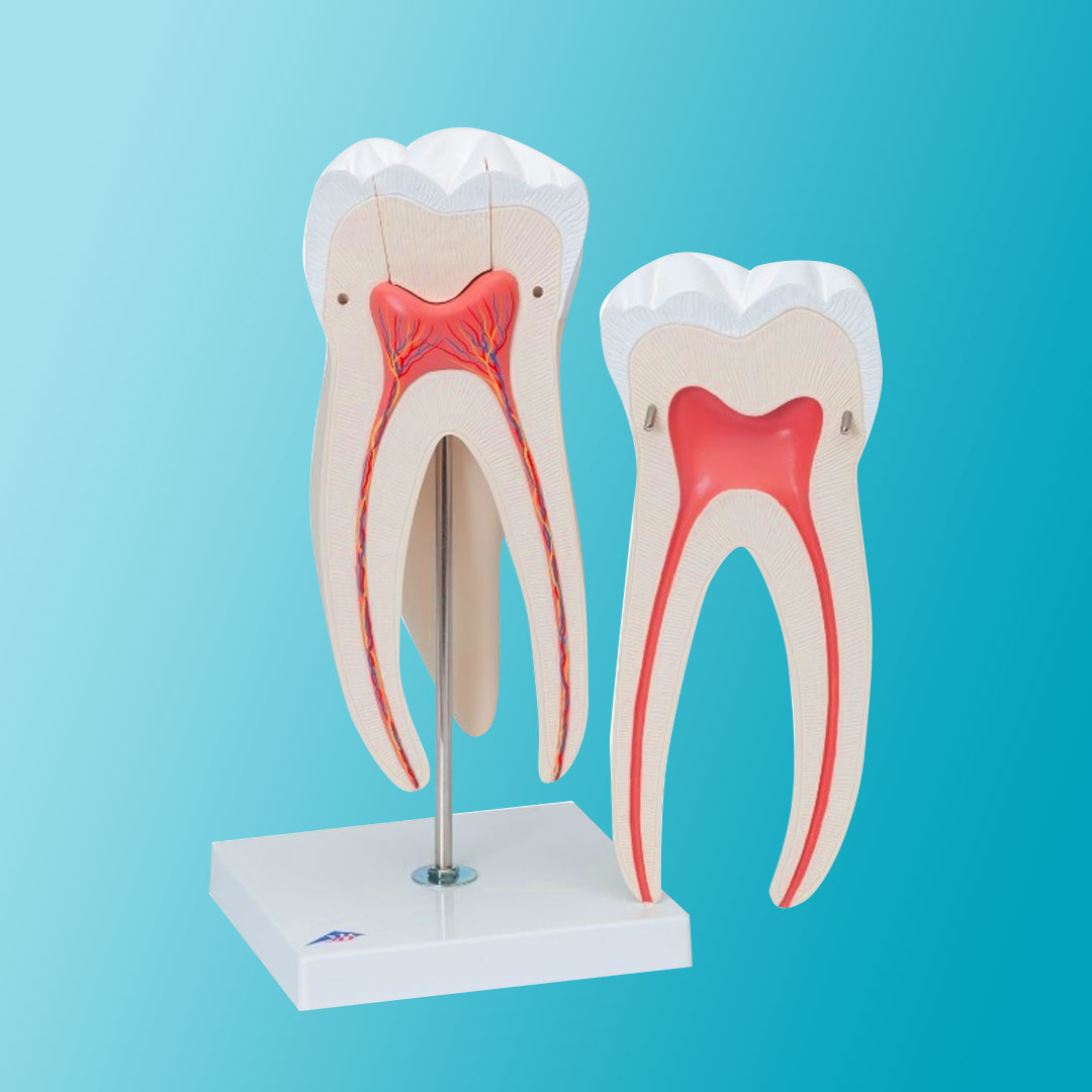 Лечение пульпита
