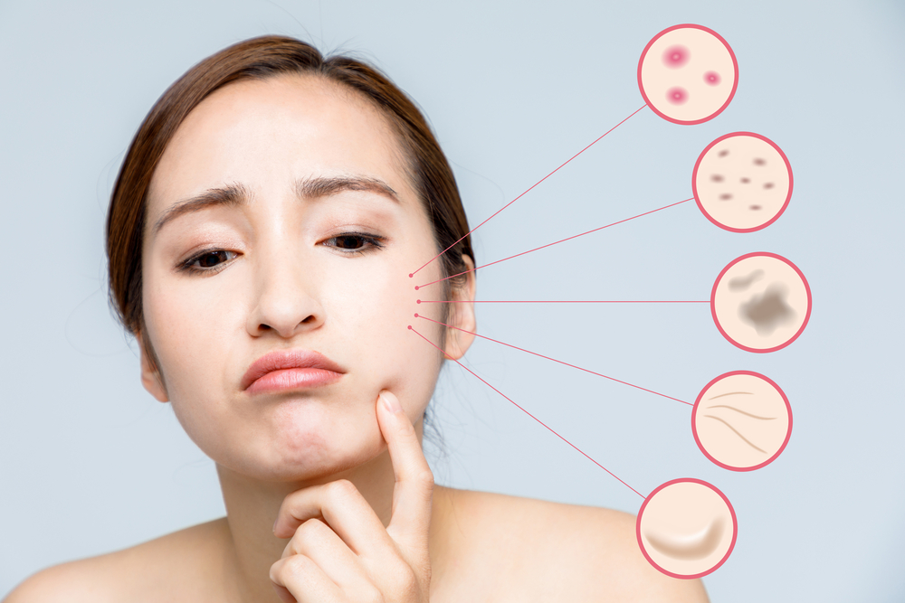 best moisturiser for sagging skin