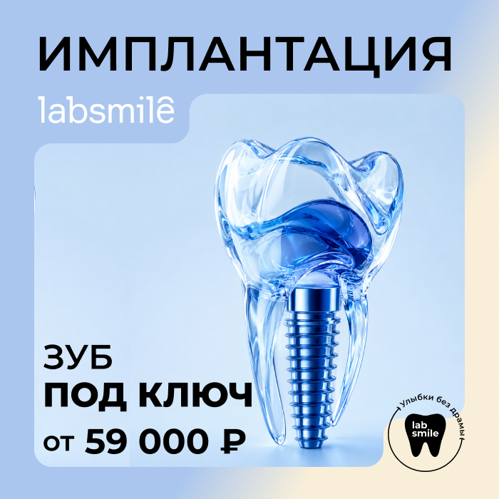 Имплантация зуба «под ключ»
