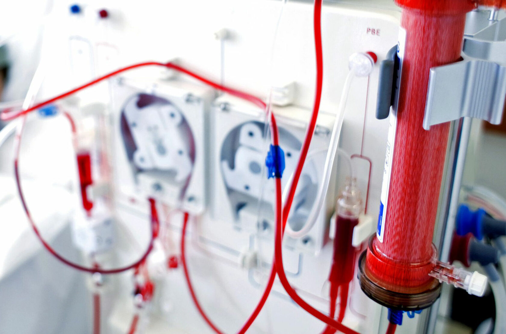 Dialysis Consumables