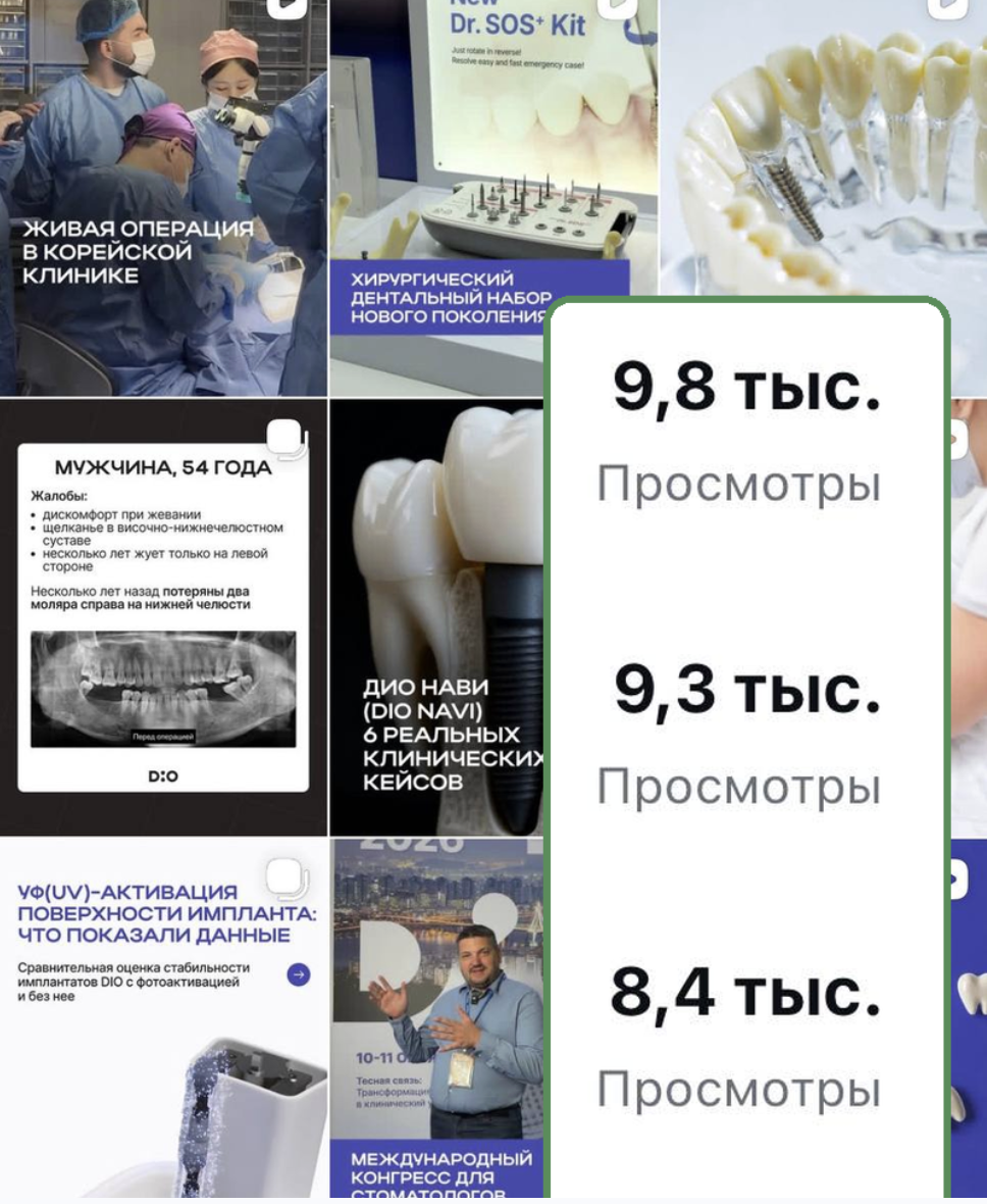 DIO IMPLANT — фото проекта