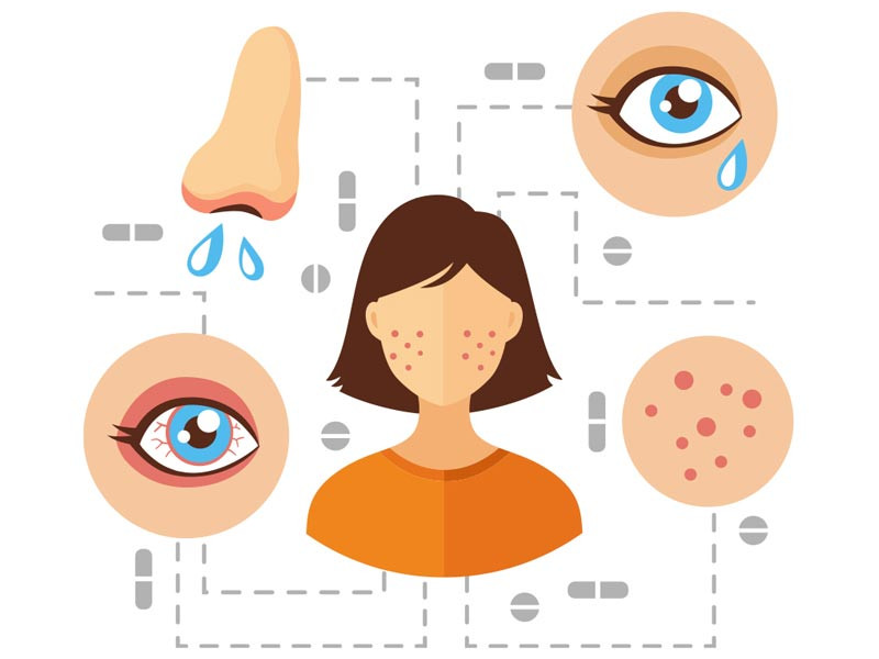 Аллергический ринит у взрослых и детей: причины, симптомы и лечение