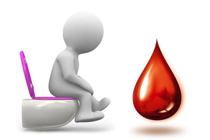 Кровотечение при геморрое - быстрая помощь и лечение