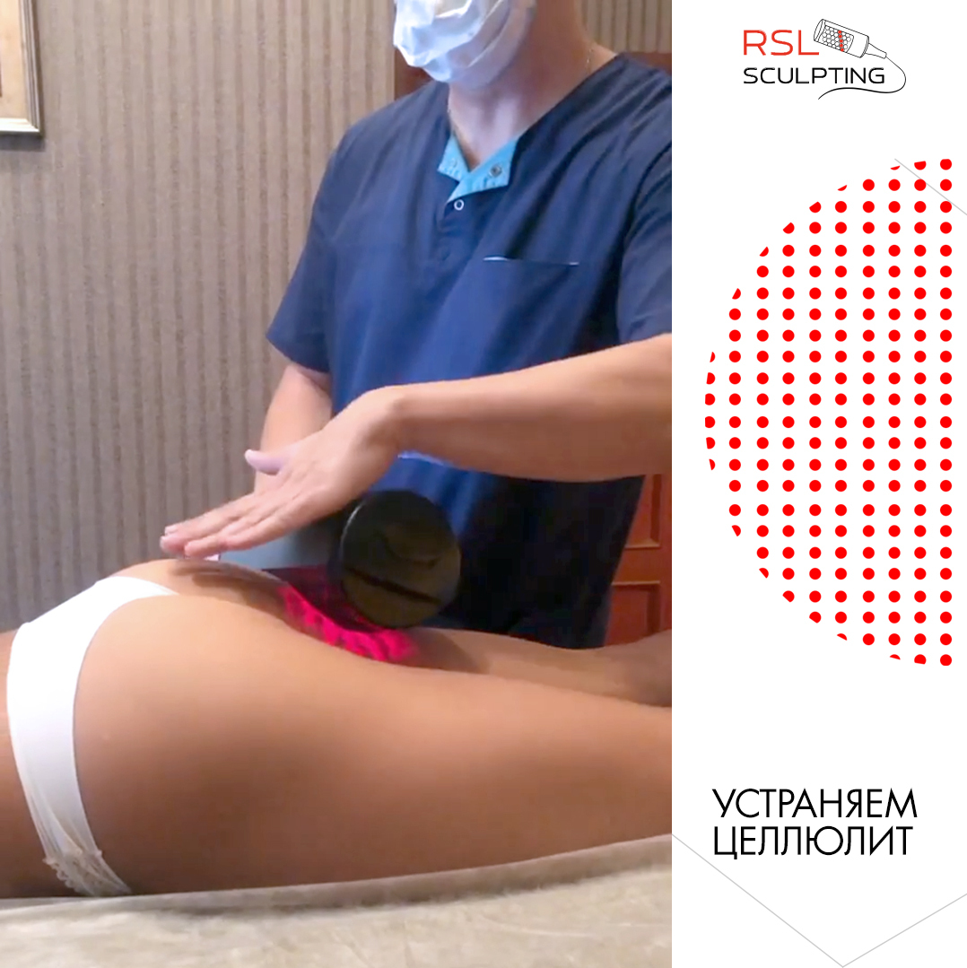 Процедура РСЛ-скульптурирования на аппарате Beautylizer RSL