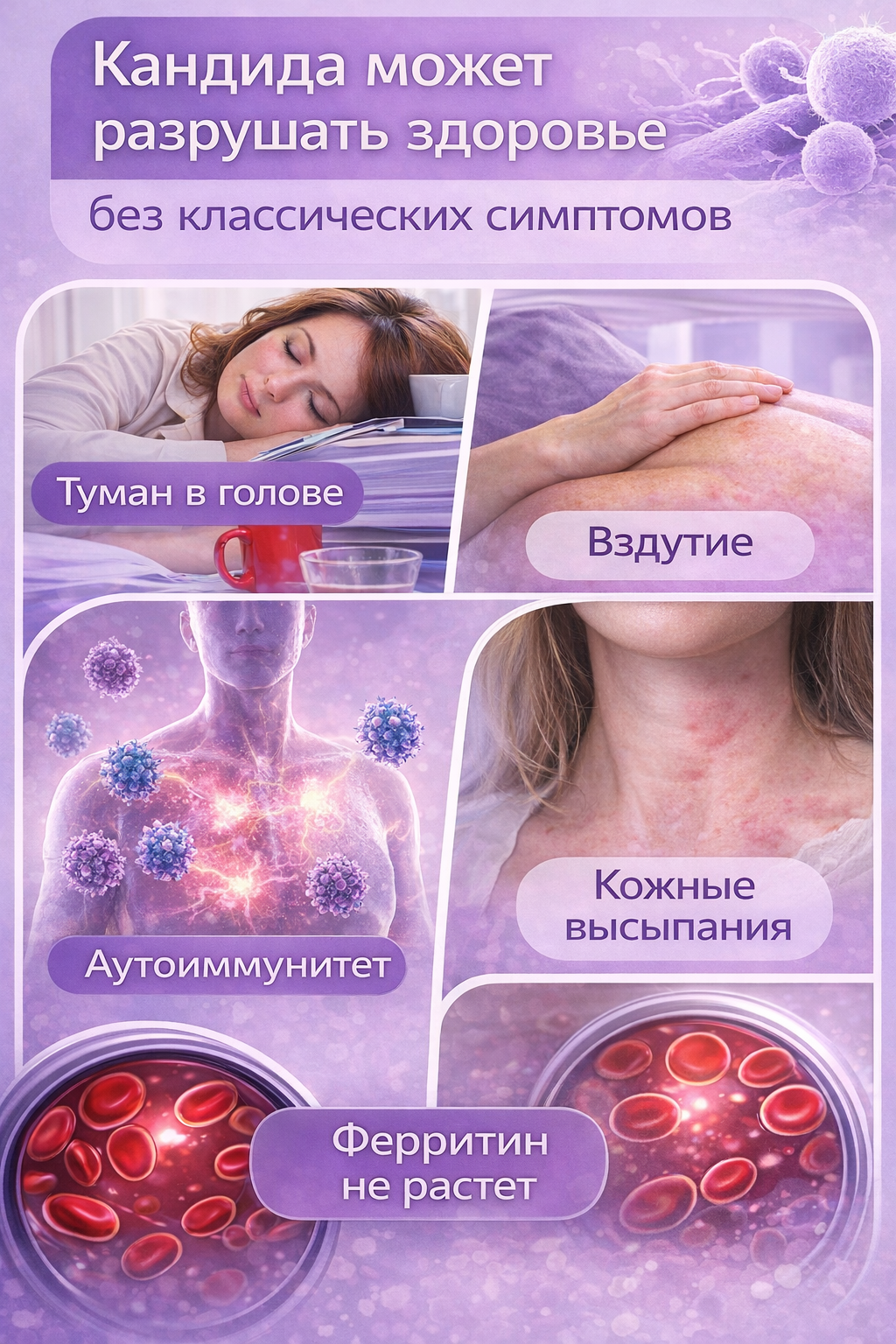 Candida может разрушать здоровье без классических симптомов