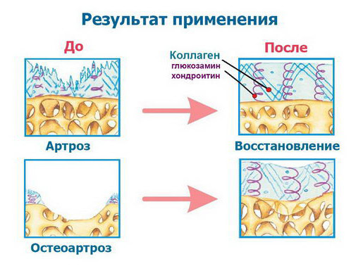 Коллаген в костной ткани