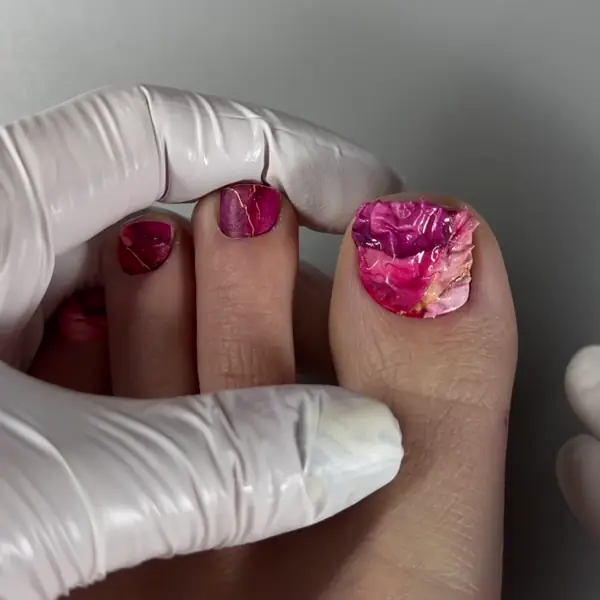 Regular Removal Step 2