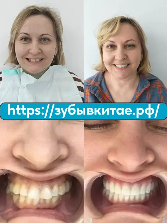 До и после — кейс 19