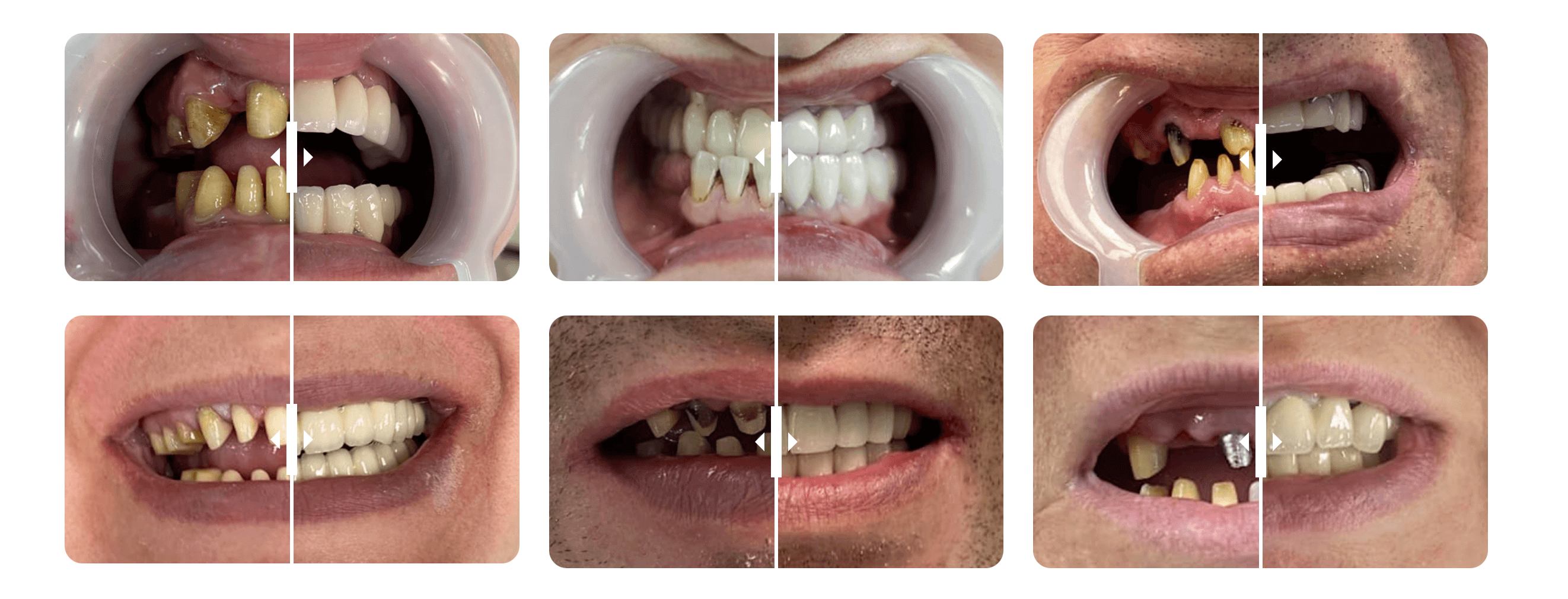 результаты работ по лечению зубов в Китае