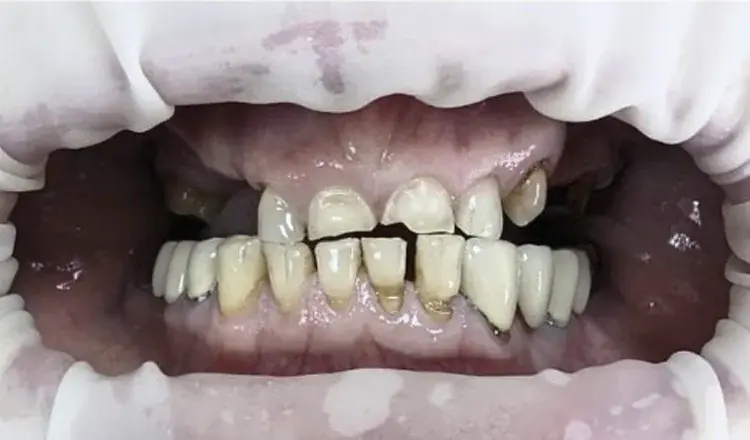 Пациент до лечения: кейс 1