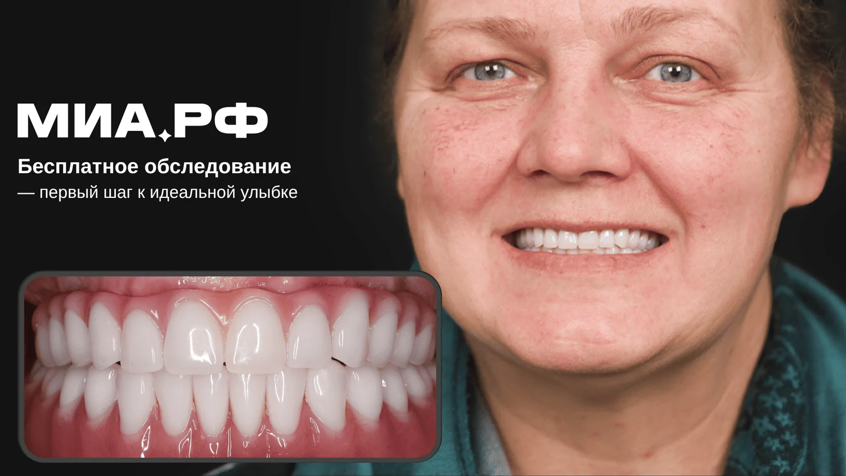 После