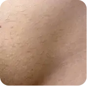 После