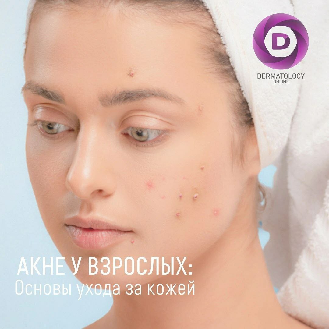 Акне у взрослых, уход за кожей, лечение