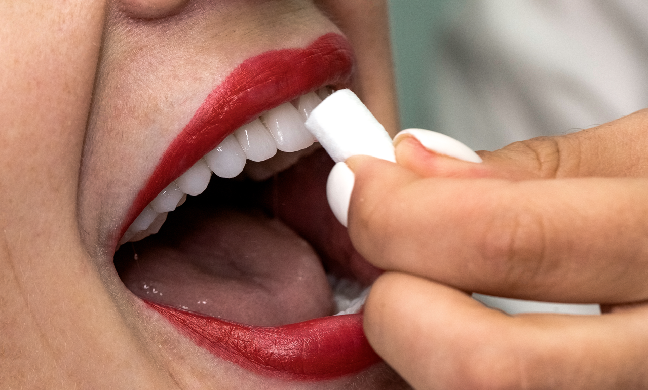 Профессиональная гигиена