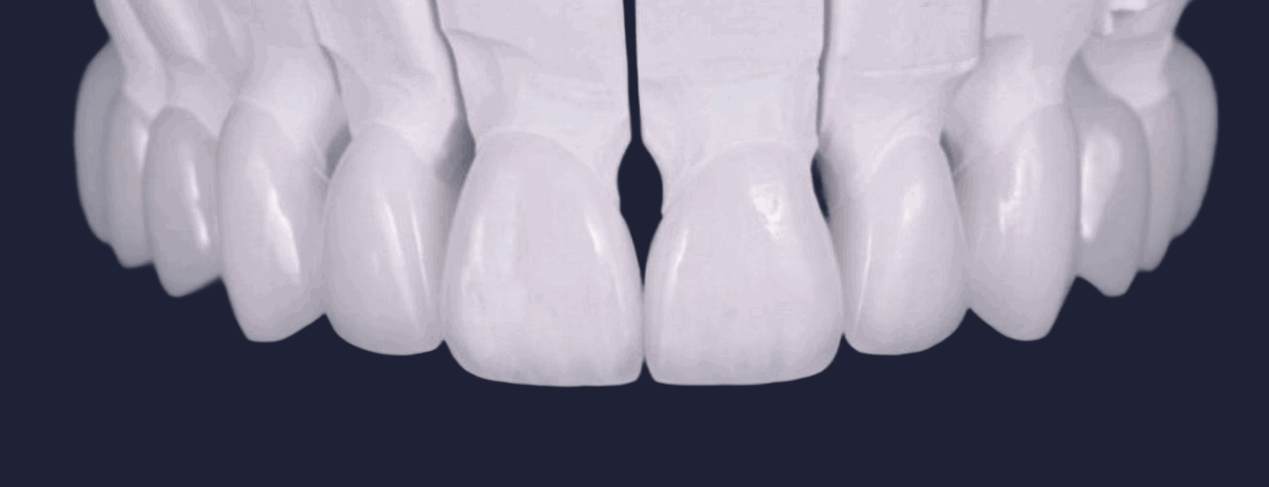 ELKO — зуботехническая лаборатория / фрезерный центр